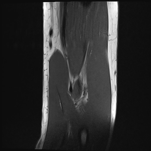 Click on the Serie image to view the images of Wieszt, Gnter